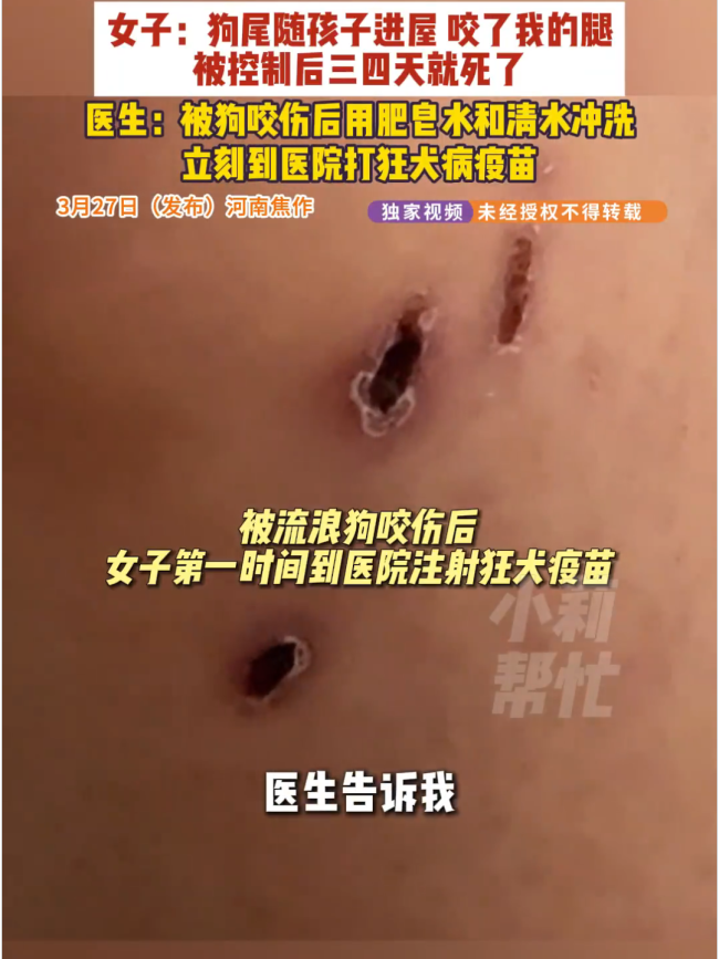 女子被流浪狗咬伤3天后狗死了 狂犬病阳性引担忧