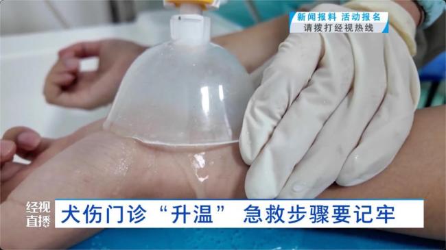 须眉看到狗打架拉架被握咬伤 春季动物致伤增多