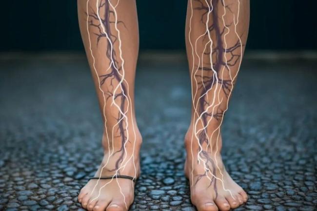 浙江大伯蚯蚓腿被胶水粘好了