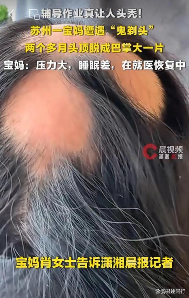 85后宝妈辅导作业遭遇鬼剃头