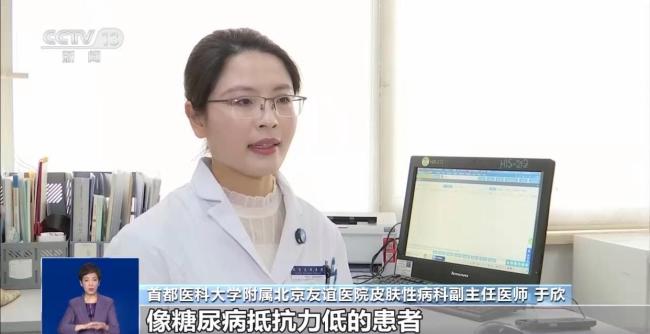 美甲暗藏健康隐患 这几类人群要注意 从“种草”到“避雷”