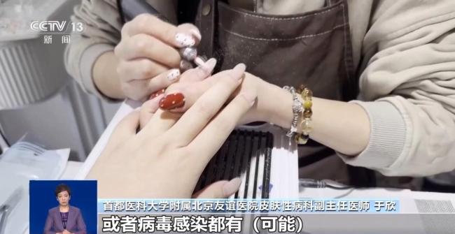 美甲暗藏健康隐患 这几类人群要注意 从“种草”到“避雷”