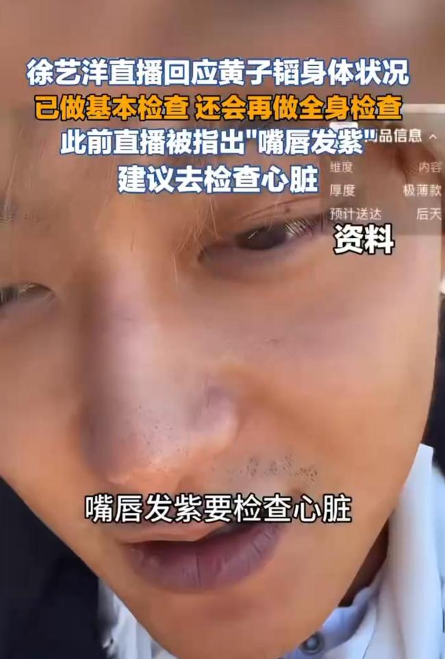 黄子韬最新回应嘴唇发紫