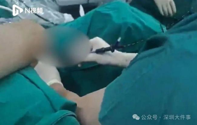 男子网购硅胶注射下体致溃烂发臭 自行整形酿悲剧