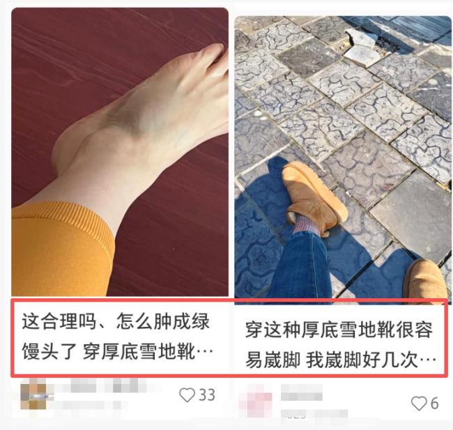 这3种网红鞋可能正在毁掉你的脚 藏在鞋柜里的“健康杀手”