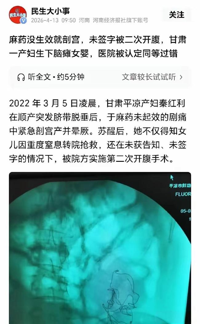 产妇遭二次开腹致女儿脑瘫