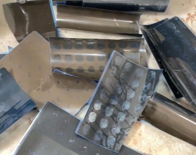 医用ct胶片怎么收纳有人回收2万张CT胶片赚2万 银价上涨推动回收热_https://www.jmylbn.com_新闻资讯_第3张