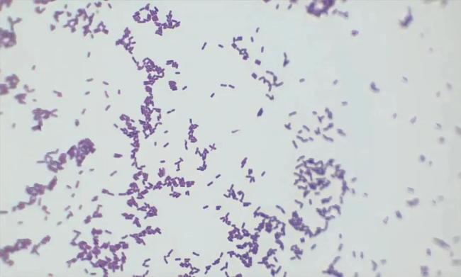 这个隐匿的“冰箱杀手”别忽视 孕妇因它不幸离世