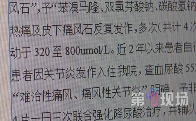 男子一天3杯奶茶手指脚趾长“巨石” 高糖引发痛风警示
