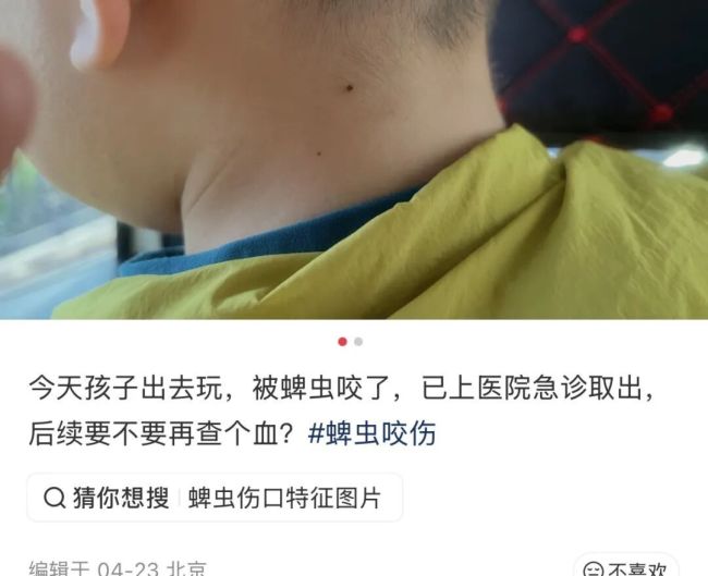 警惕！北京已有多人被叮咬，是什么毒虫？ 蜱虫活跃季需小心