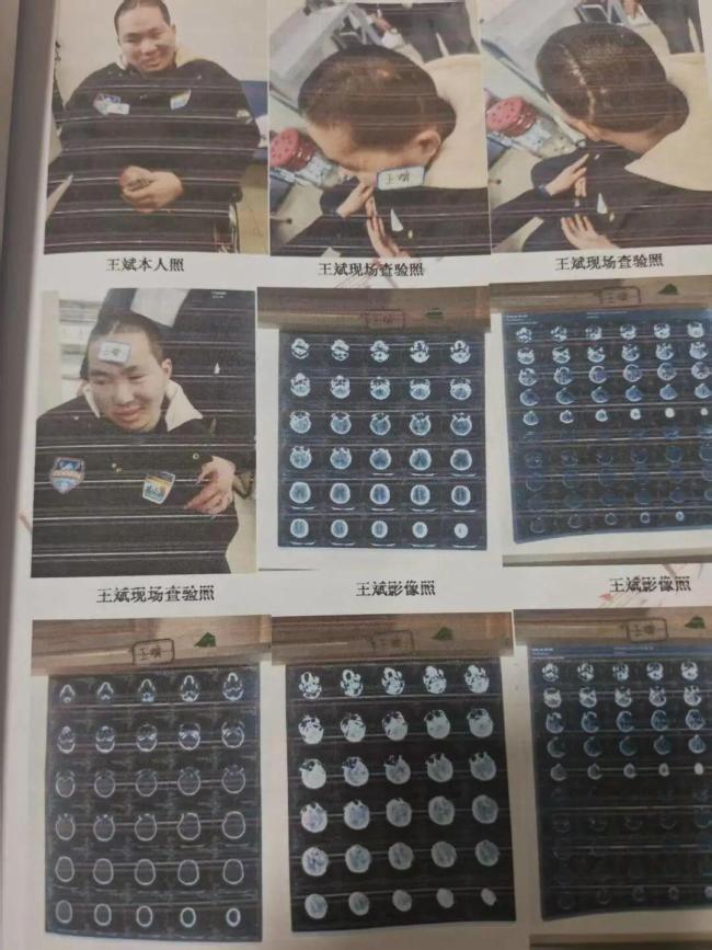 16岁少年无证驾驶撞倒23岁研究生 两个家庭的悲剧