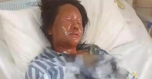 女主播被炸傷案今日開庭 持續(xù)半年的恐怖追殺