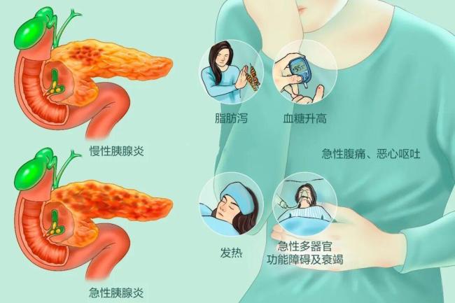 女子餓6天吃1天突然腹痛送醫(yī) 極端節(jié)食惹禍