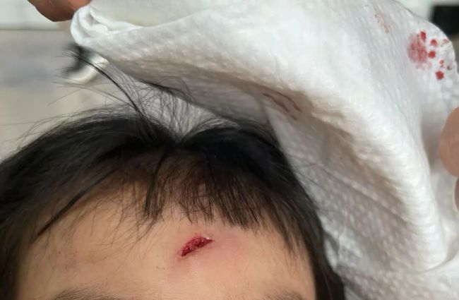 女童好奇和机器狗互动被猛撞受伤 安全措施缺失引争议