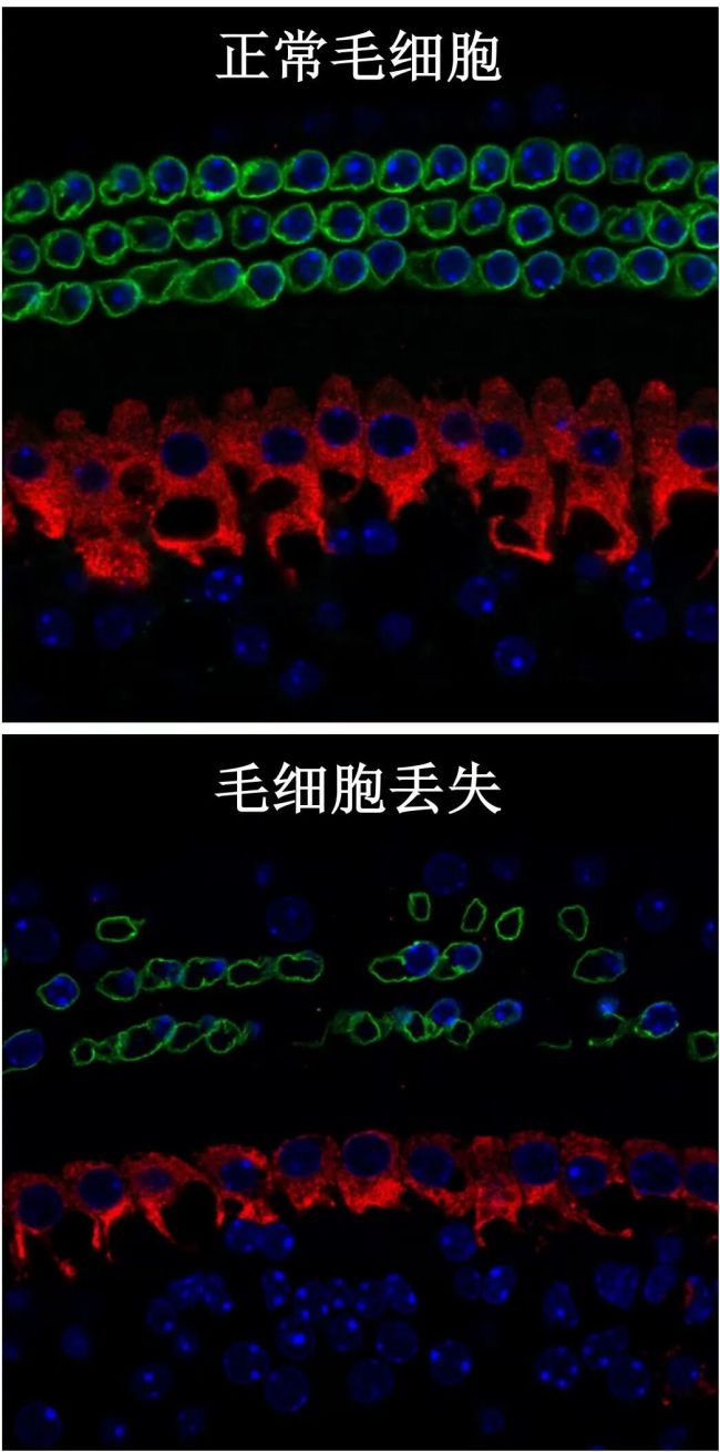 郑州一大学生蓝牙耳机爆炸 深夜惊魂未酿大祸