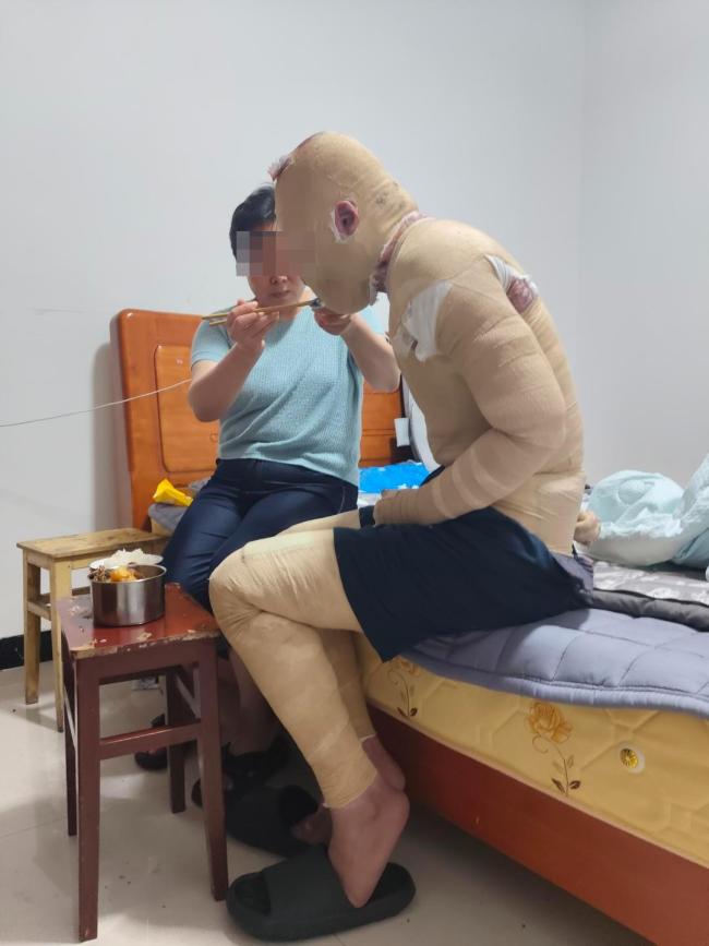 电瓶烧伤舍友男子不承担精神损失费 室友充电引发火灾