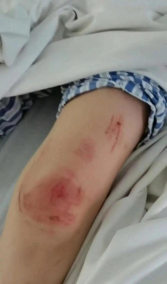 丈夫家暴后扒车 女子开车致其身亡 二审维持原判