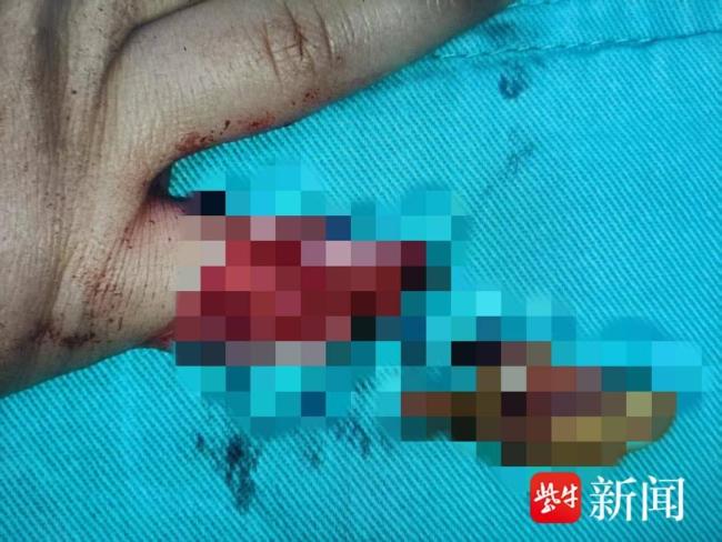 商场回应女童被滑梯夹断小拇指 安全隐患引争议