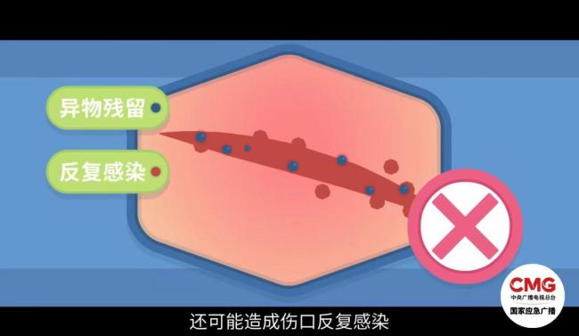 台风天这8件事千万别做 科学避险要点