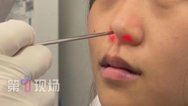 广东9岁女孩因抠鼻孔险些毁容 小动作暗藏大危机