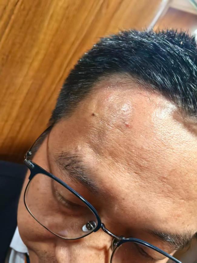 幼童跌入站台缝隙男子俯身探入救出 列车员英勇救人