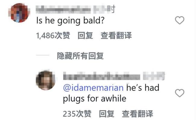 连贝克汉姆都逃不过脱发 发量告急引热议