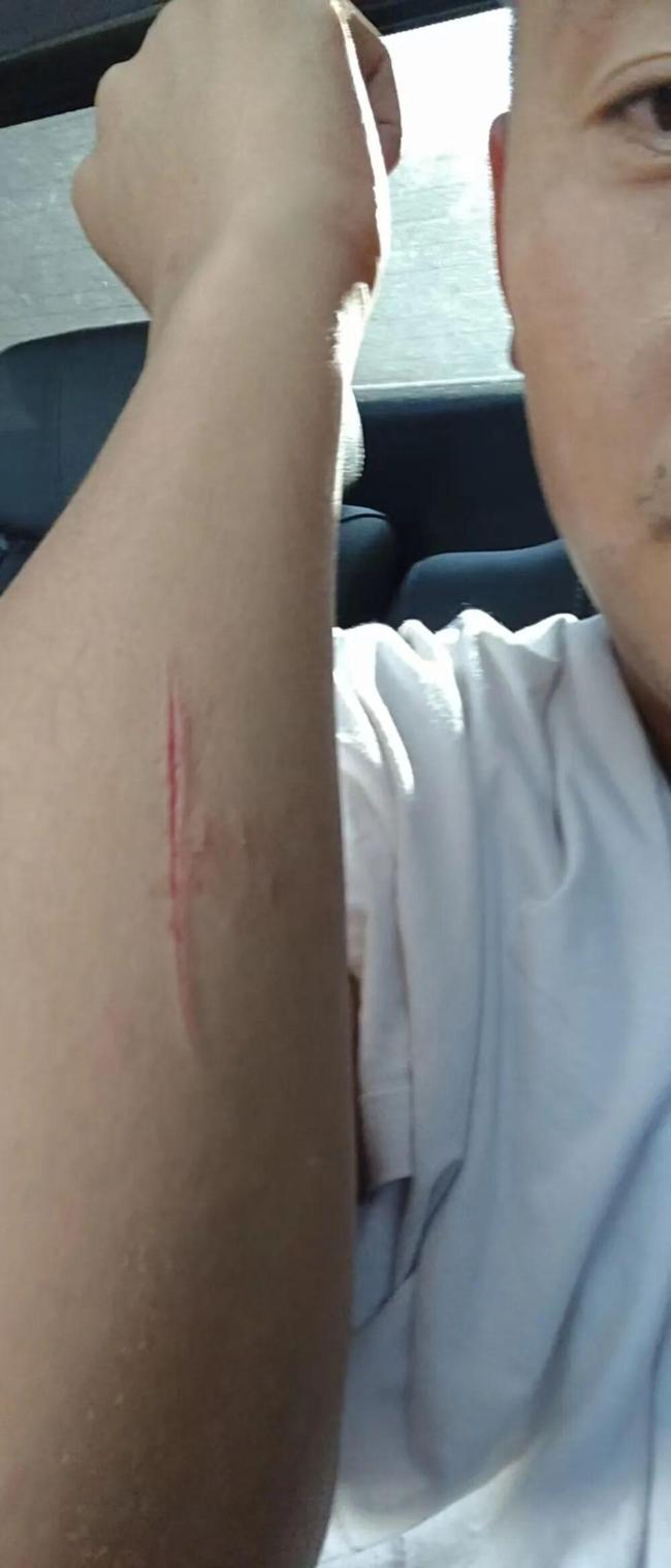 辅警勇救溺水男童手臂受伤浑然不知 危难时刻显担当
