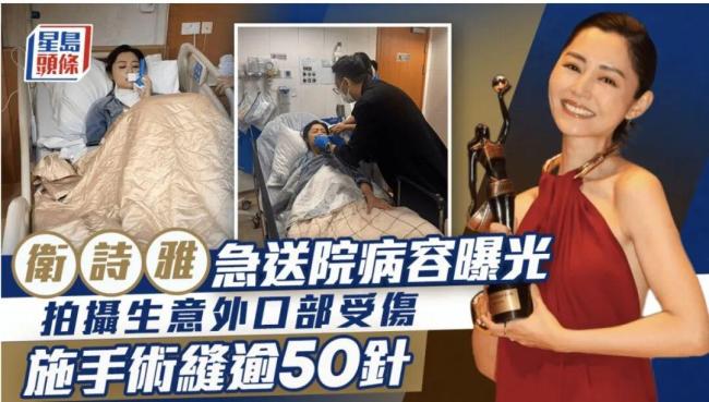 金像奖影后卫诗雅受伤缝50多针