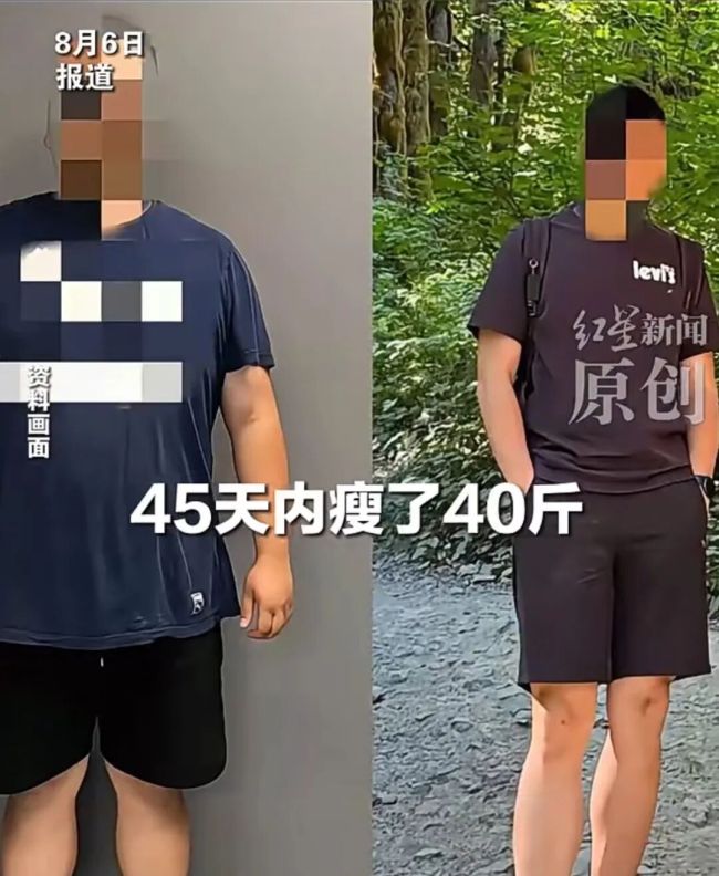 小伙靠AI减肥 45天瘦40斤进了ICU
