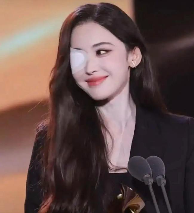 娜扎称眼睛恢复情况不太妙 仍在积极治疗中