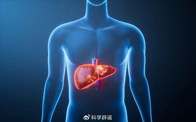 少吃肥肉就能远离脂肪肝了?