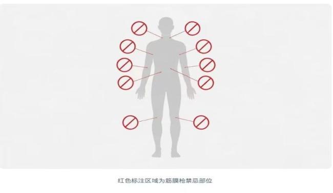 康复治疗师教你怎么使用筋膜枪 正确手法与禁忌部位解析