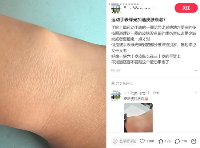 智能手表还能不能放心戴