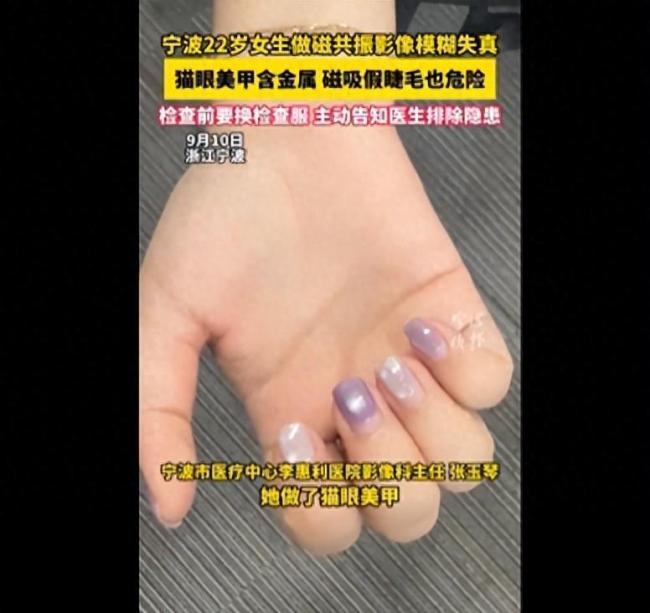 女子因猫眼美甲做磁共振片子全废