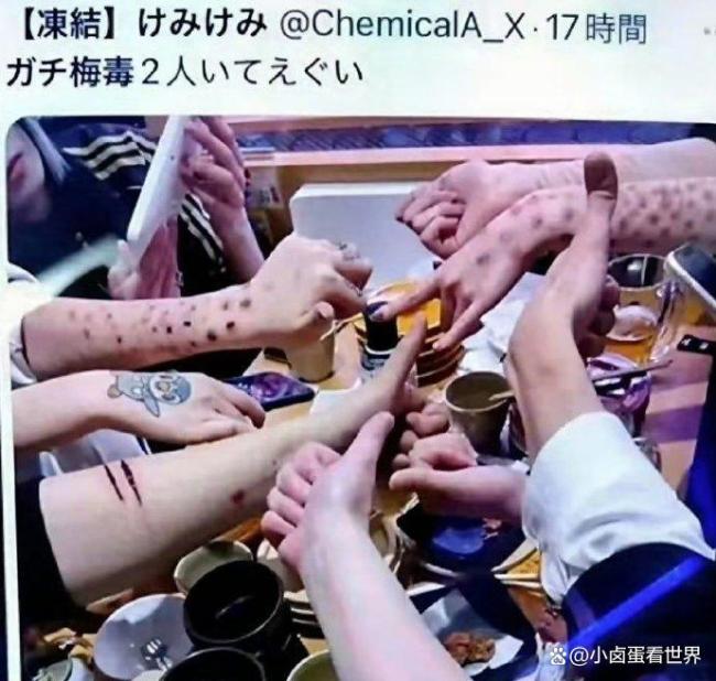 日本的梅毒到底严重到什么地步 感染人数激增十倍