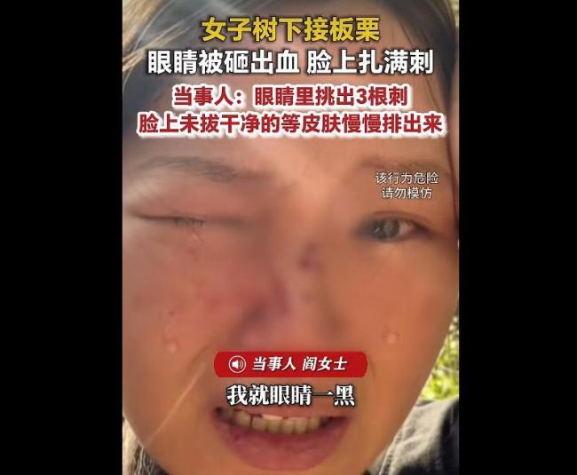 女子被板栗砸伤眼睛里挑出刺 提醒勿直视捡拾
