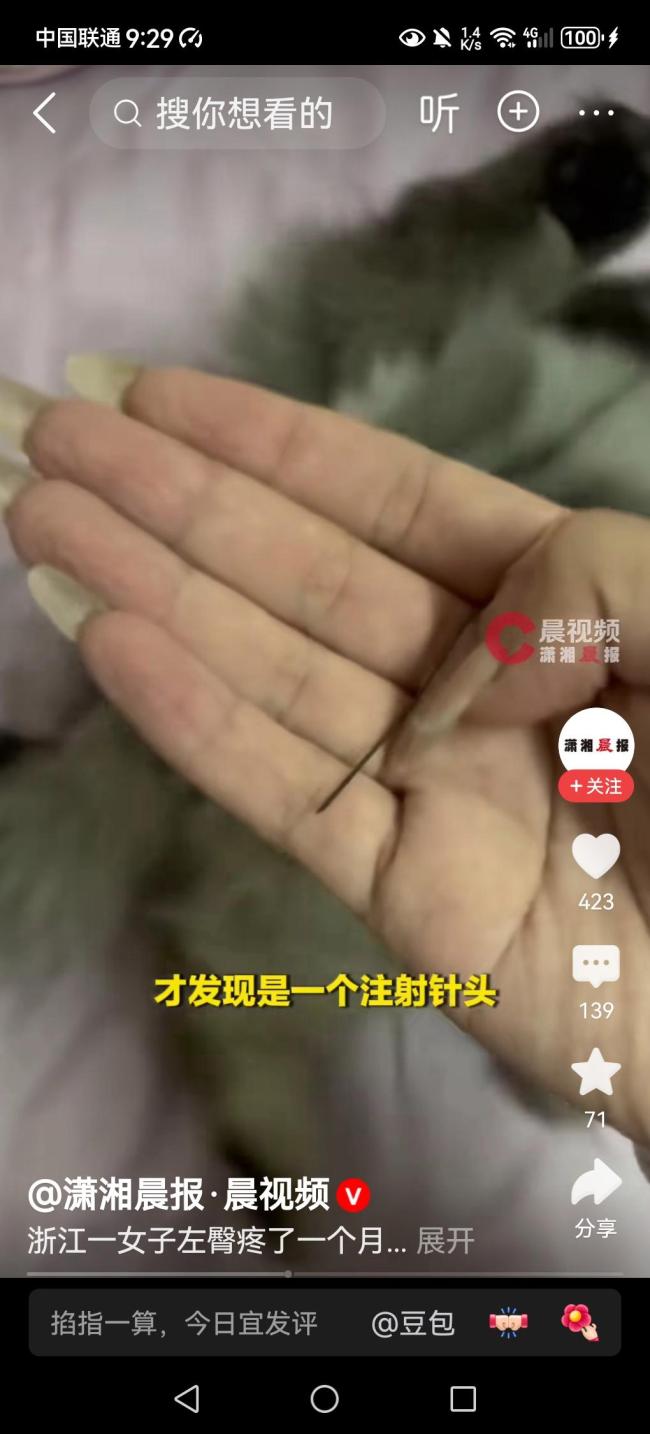 臀部取出针头女子每天骑共享单车 异物潜伏一个月
