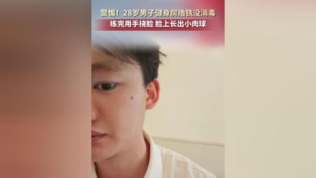 撸铁后挠脸 男子脸上长出“小肉球” 健身卫生需重视