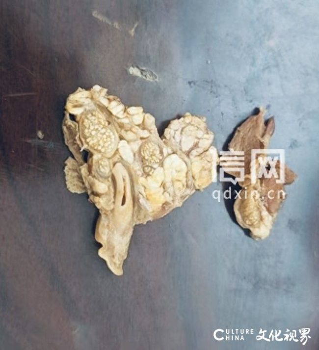 天天3·15 | 海底捞自热火锅疑现淋巴肉？消费者追问遭商家平台“踢皮球”