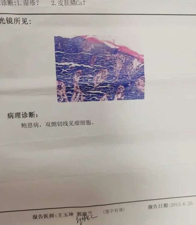 12年抗癌路、3次手术未果——银丰（济南）医院助鲍温氏病患者重归健康