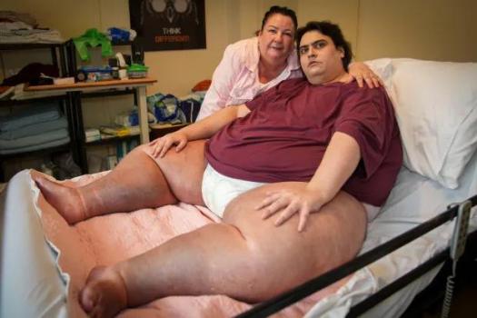 英国600斤男子去世，自认童年不幸导致暴食，无法工作靠救济为生