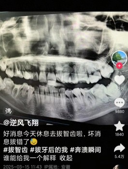 家属称坠亡女子好牙被拔时没打麻药 医生操作失误引争议