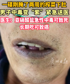 男子吃腌菜中毒變“紫”緊急送醫(yī) 醫(yī)生：亞硝酸鹽急性中毒致死,，長期吃致癌