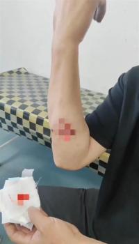 司机深夜下车睡觉被狼咬伤 无人区野狼袭击事件