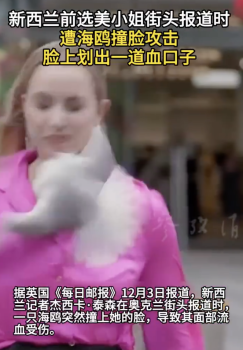 新西兰前选美小姐遭海鸥撞脸攻击 街头报道意外受伤