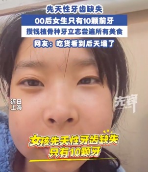 00后女子天生只有10颗牙 原来真有人没体验过后牙咀嚼