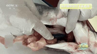 女子生吞鱼胆中毒全身发黄 误信偏方险丧命