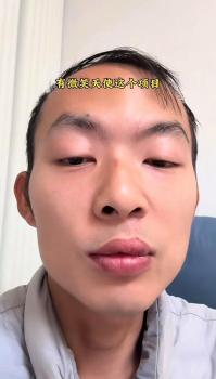 嫣然基金受益者称只花了食宿费路费 患者发声支持