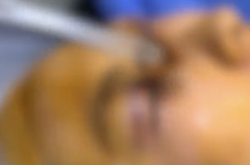 女子割双眼皮修复4次后仍像悲伤蛙 医生紧急提醒：爱美路上最忌讳盲目跟风