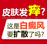 患者怎样治疗白癜风更加科学?